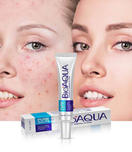 BIOAQUA Pure Skin Acne Removal Cream