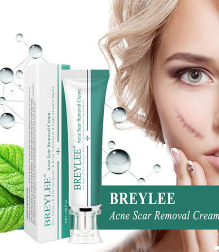 Breylee Acne Scar Removal Cream