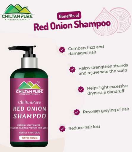 Chiltan Pure Red Onion Shampoo