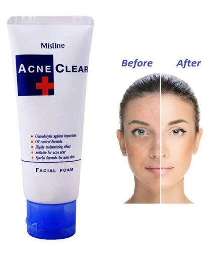 Mistine Acne Clear Face Wash Facial Foam 85 ml In Pakistan